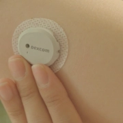 持続グルコース測定器（CGM）の活用