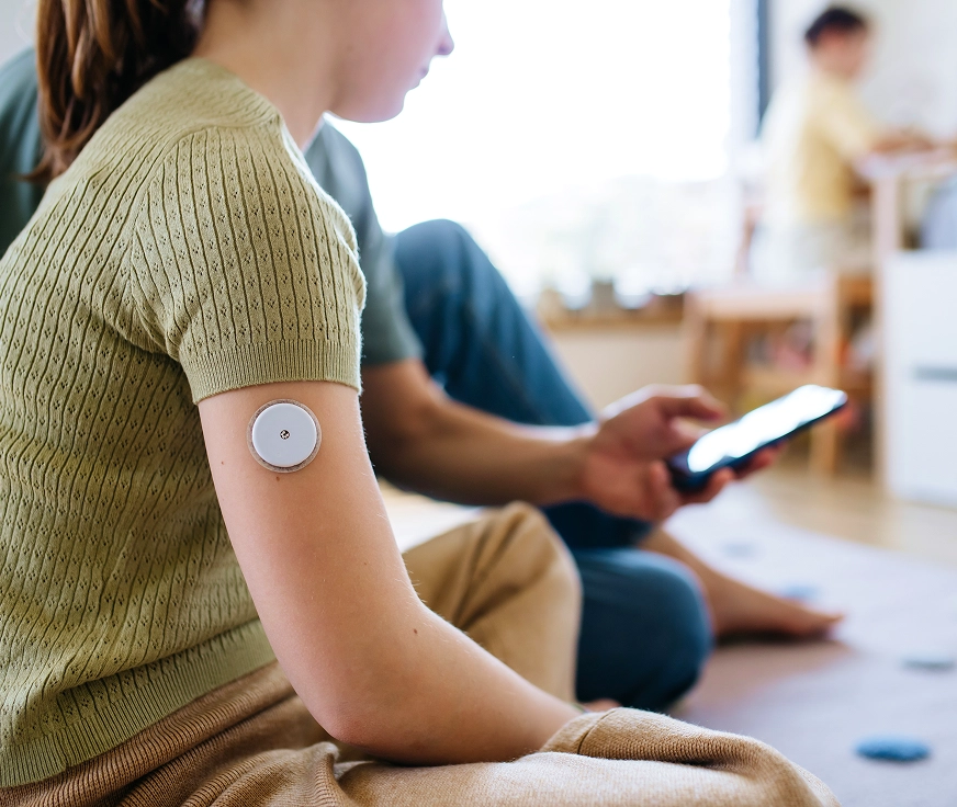 CGMセンサーを装着した様子